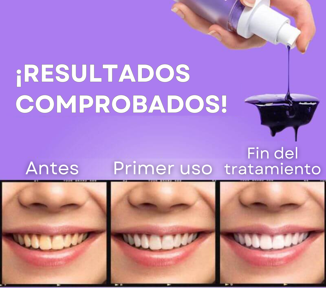 Gel V34 - Blanqueamiento Dental + Pasta con ácido hialurónico (GRATIS)