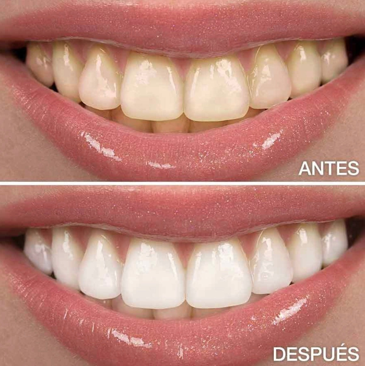 Gel V34 - Blanqueamiento Dental + Pasta con ácido hialurónico (GRATIS)